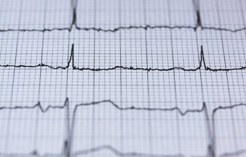 Killers on the rise, says study